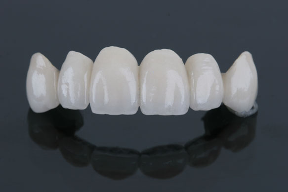 Crowns